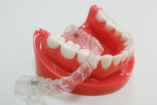 マウスピース型歯科矯正装置（インビザライン）